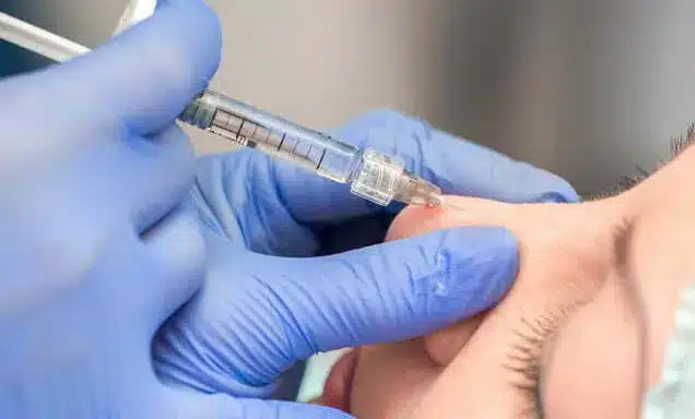 Rinomodelación no quirúrgica