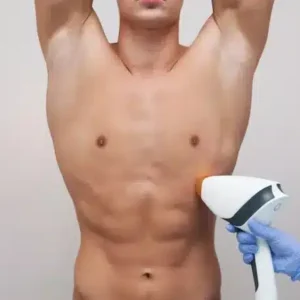 Depilación Láser Abdomen, Pecho y Cuello